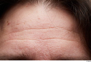  HD Face Skin Arron Cooper face forehead skin pores skin texture wrinkles 0002.jpg
